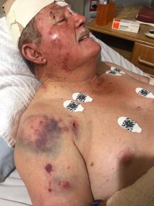 #FARMATTACK: Miracle After Miracle Saves Missionary Farmer’s Life After Attack – Midvaal