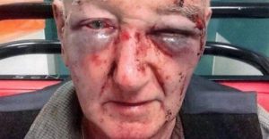 Farmer (80) Interrogated, Brutally Assaulted And Stabbed – Paul Roux